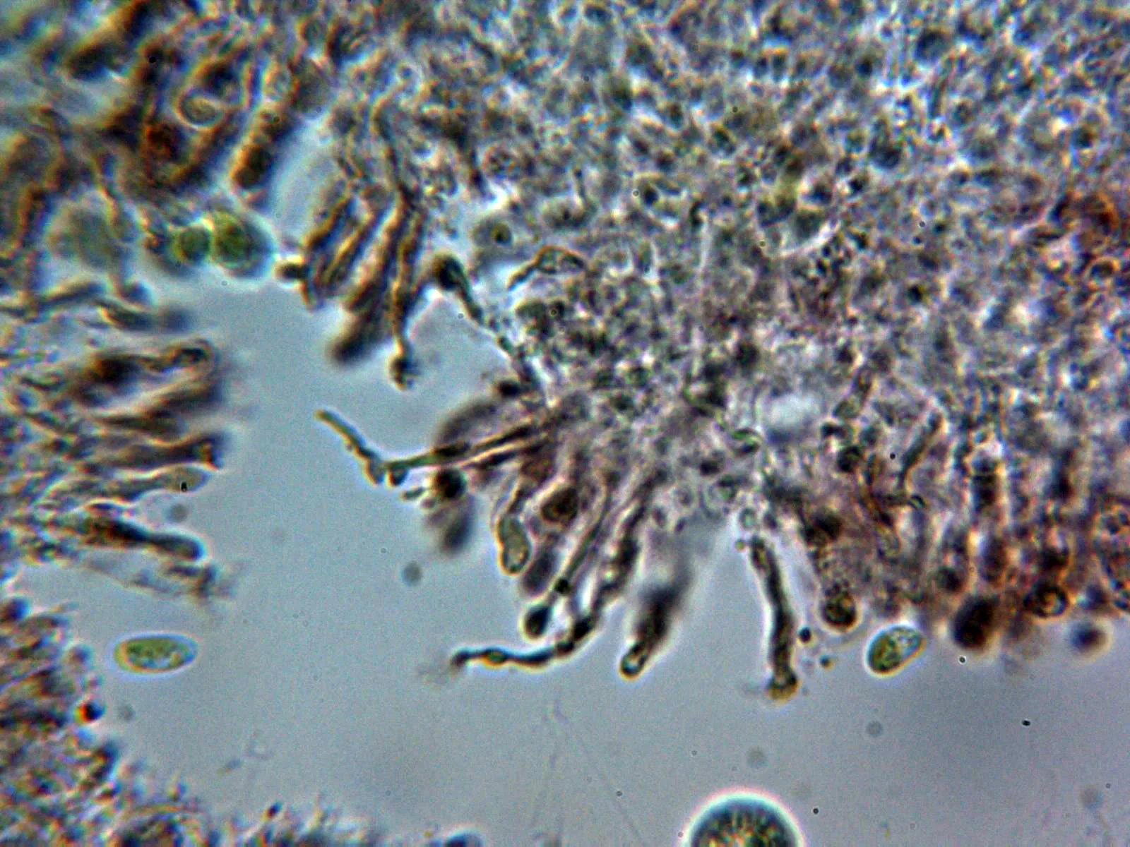 Microscopía de Cabalodontia subcretacea - 10 - Hifas subiculares 5